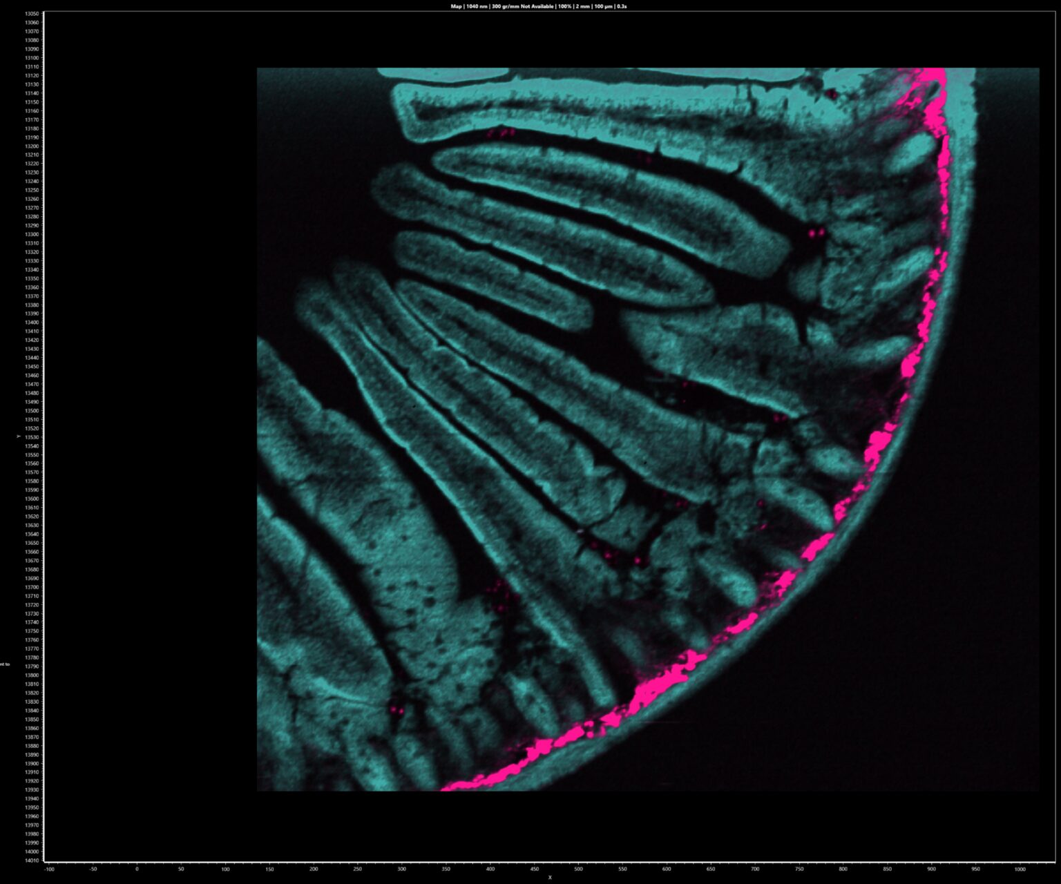 Second Microscope Second Harmonic Generation Microscopy with the RMS1000 Confocal ...